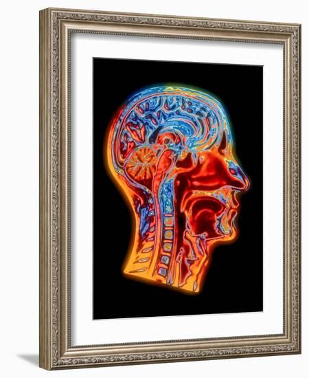 Coloured MRI Scan of the Human Head (side View)-PASIEKA-Framed Photographic Print