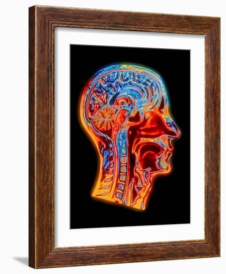 Coloured MRI Scan of the Human Head (side View)-PASIEKA-Framed Photographic Print