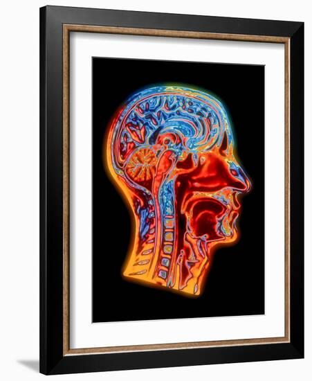 Coloured MRI Scan of the Human Head (side View)-PASIEKA-Framed Photographic Print