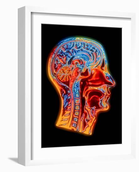 Coloured MRI Scan of the Human Head (side View)-PASIEKA-Framed Photographic Print