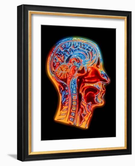 Coloured MRI Scan of the Human Head (side View)-PASIEKA-Framed Photographic Print