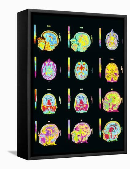 Coloured MRI Scans of Human Brain (multiple Views)-Mehau Kulyk-Framed Premier Image Canvas