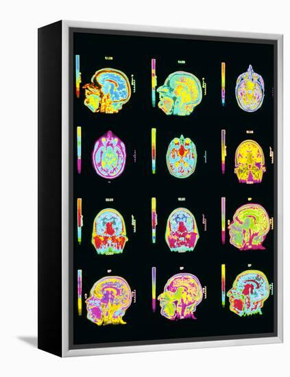 Coloured MRI Scans of Human Brain (multiple Views)-Mehau Kulyk-Framed Premier Image Canvas