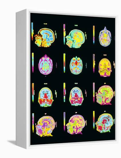 Coloured MRI Scans of Human Brain (multiple Views)-Mehau Kulyk-Framed Premier Image Canvas