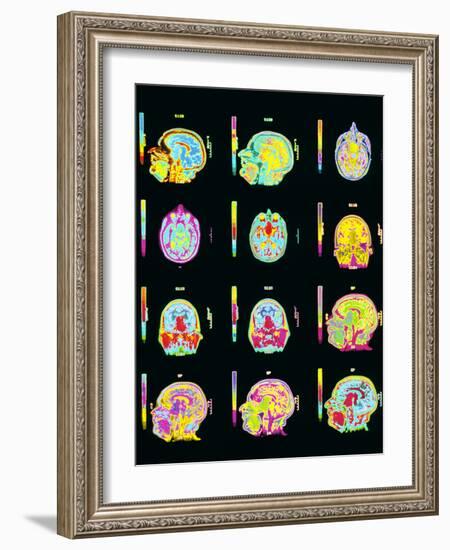 Coloured MRI Scans of Human Brain (multiple Views)-Mehau Kulyk-Framed Photographic Print