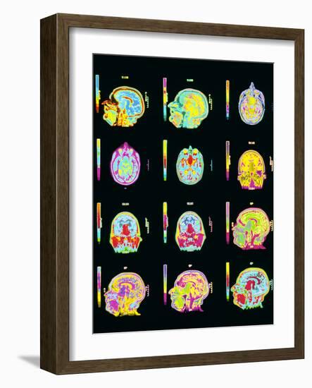 Coloured MRI Scans of Human Brain (multiple Views)-Mehau Kulyk-Framed Photographic Print