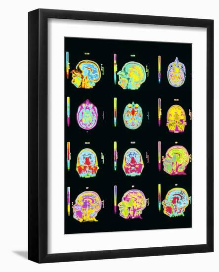 Coloured MRI Scans of Human Brain (multiple Views)-Mehau Kulyk-Framed Photographic Print