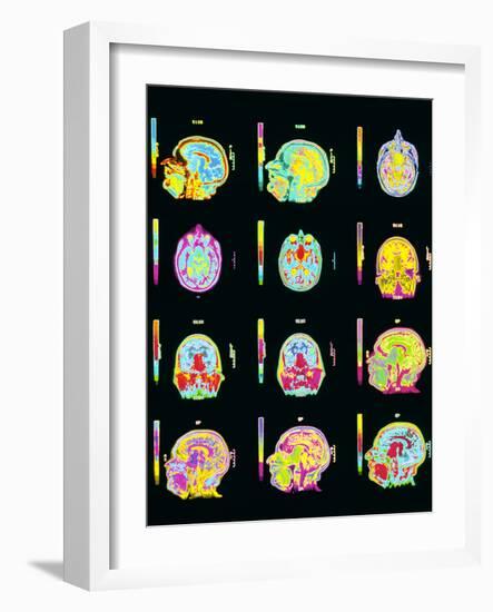 Coloured MRI Scans of Human Brain (multiple Views)-Mehau Kulyk-Framed Photographic Print