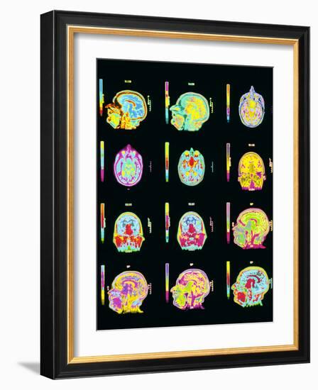 Coloured MRI Scans of Human Brain (multiple Views)-Mehau Kulyk-Framed Photographic Print