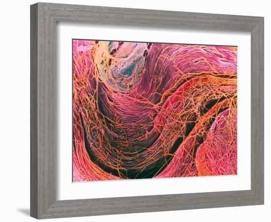 Coloured SEM of Collagen Connective Tissue Fibres-Steve Gschmeissner-Framed Photographic Print