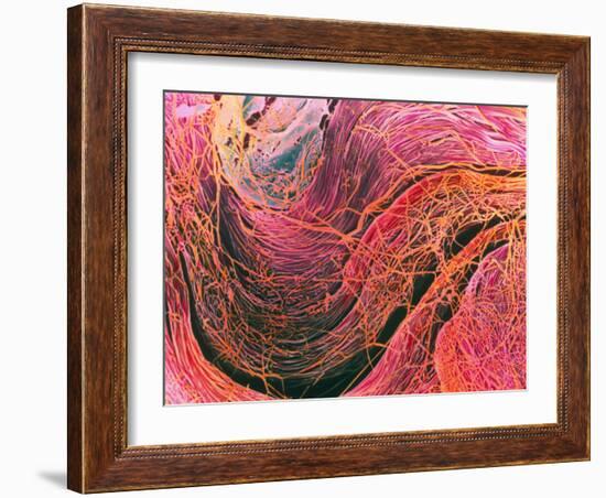 Coloured SEM of Collagen Connective Tissue Fibres-Steve Gschmeissner-Framed Photographic Print