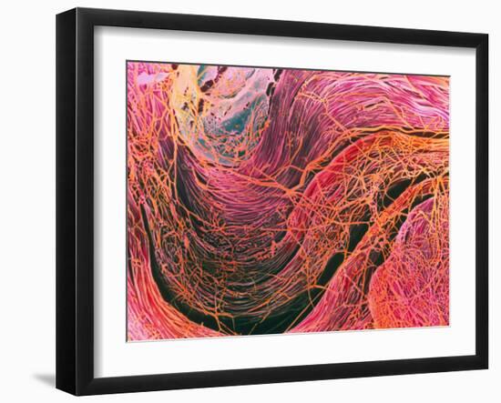 Coloured SEM of Collagen Connective Tissue Fibres-Steve Gschmeissner-Framed Photographic Print