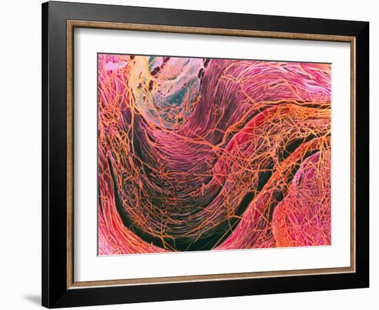 Coloured SEM of Collagen Connective Tissue Fibres-Steve Gschmeissner-Framed Photographic Print