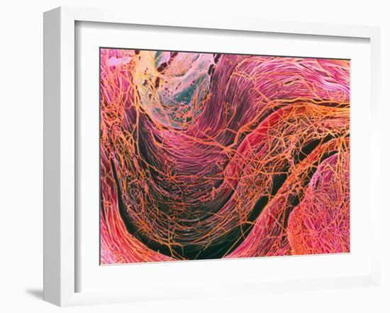 Coloured SEM of Collagen Connective Tissue Fibres-Steve Gschmeissner-Framed Photographic Print