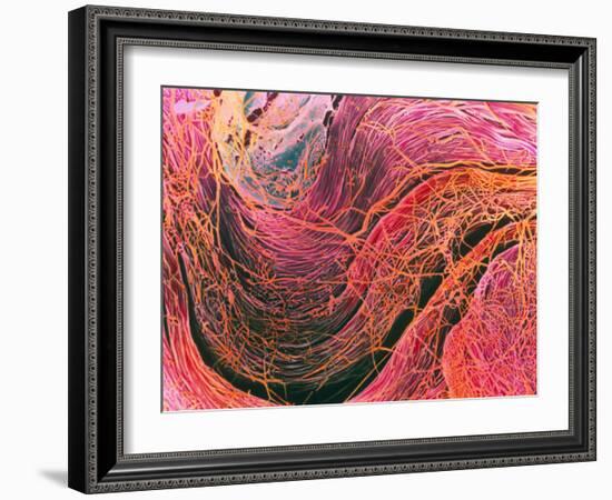 Coloured SEM of Collagen Connective Tissue Fibres-Steve Gschmeissner-Framed Photographic Print