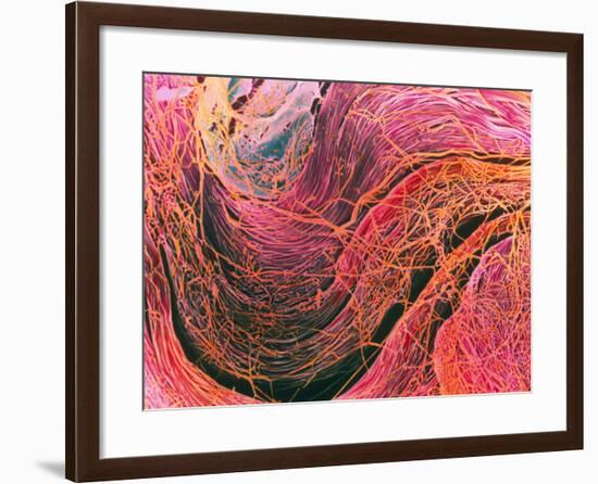 Coloured SEM of Collagen Connective Tissue Fibres-Steve Gschmeissner-Framed Photographic Print