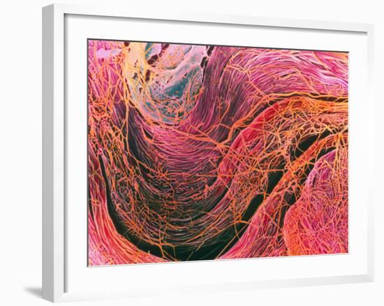 Coloured SEM of Collagen Connective Tissue Fibres-Steve Gschmeissner-Framed Photographic Print