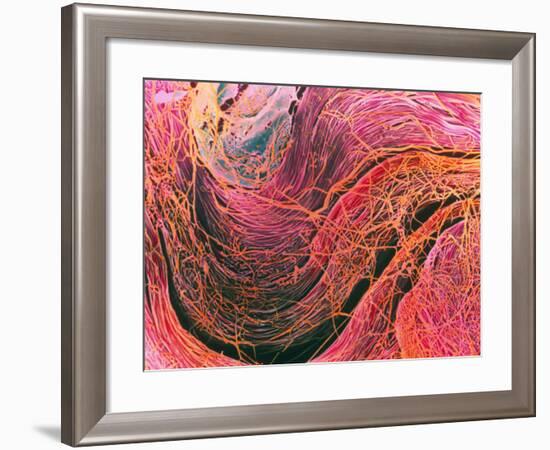 Coloured SEM of Collagen Connective Tissue Fibres-Steve Gschmeissner-Framed Photographic Print