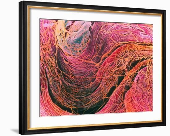 Coloured SEM of Collagen Connective Tissue Fibres-Steve Gschmeissner-Framed Photographic Print