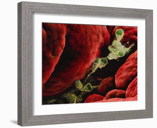 Coloured SEM of Giardia Lamblia In Human Intestine-P.m. Motta-Framed Photographic Print