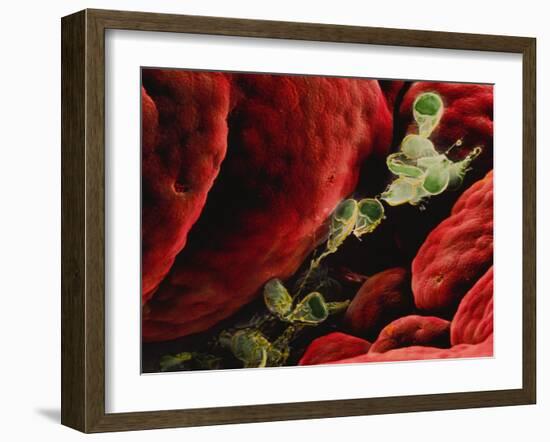 Coloured SEM of Giardia Lamblia In Human Intestine-P.m. Motta-Framed Photographic Print