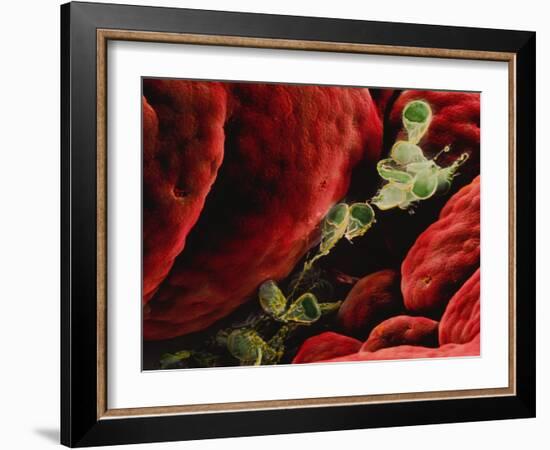 Coloured SEM of Giardia Lamblia In Human Intestine-P.m. Motta-Framed Photographic Print