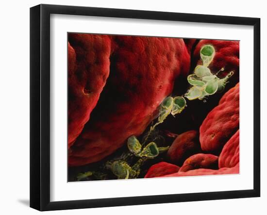 Coloured SEM of Giardia Lamblia In Human Intestine-P.m. Motta-Framed Photographic Print