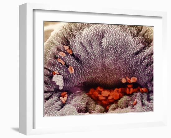 Coloured SEM of Mouth of Schistosome Parasite-NIBSC-Framed Photographic Print