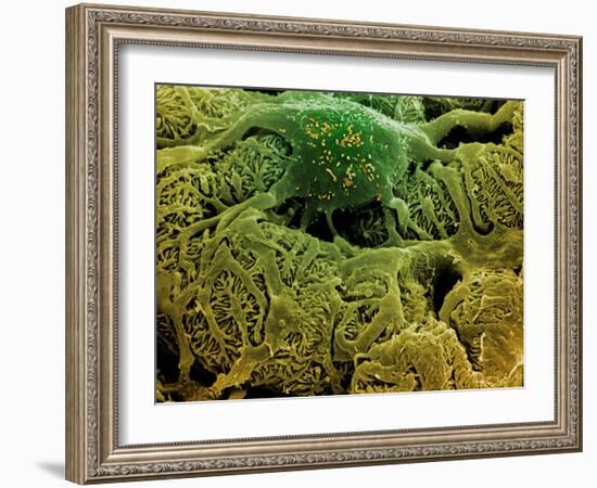 Coloured SEM of Podocytes In the Human Kidney-Steve Gschmeissner-Framed Photographic Print