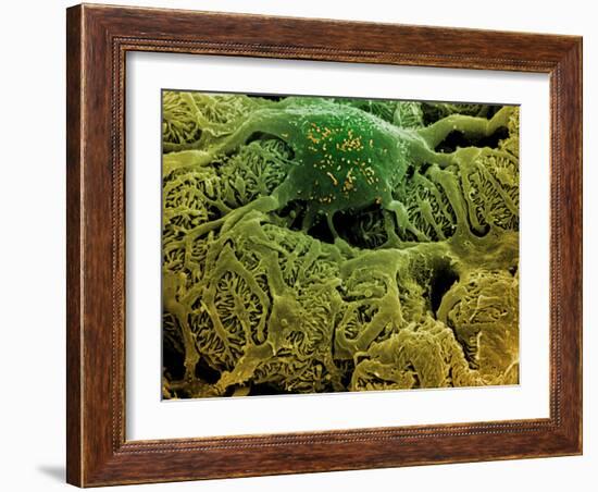 Coloured SEM of Podocytes In the Human Kidney-Steve Gschmeissner-Framed Photographic Print