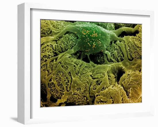 Coloured SEM of Podocytes In the Human Kidney-Steve Gschmeissner-Framed Photographic Print