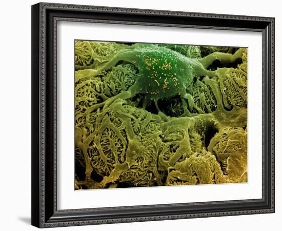 Coloured SEM of Podocytes In the Human Kidney-Steve Gschmeissner-Framed Photographic Print