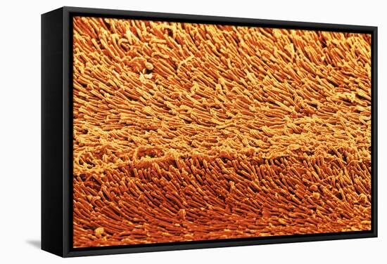 Coloured SEM of Rod Cells In the Retina of the Eye-Steve Gschmeissner-Framed Premier Image Canvas