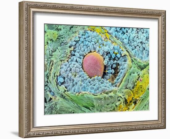 Coloured SEM of Secondary Follicles In the Ovary-null-Framed Photographic Print