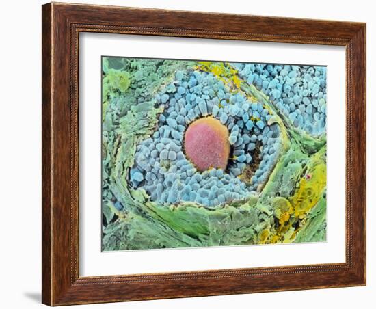 Coloured SEM of Secondary Follicles In the Ovary-null-Framed Photographic Print