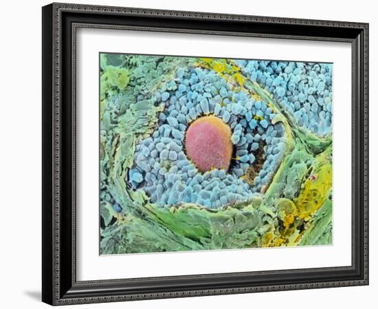 Coloured SEM of Secondary Follicles In the Ovary-null-Framed Photographic Print