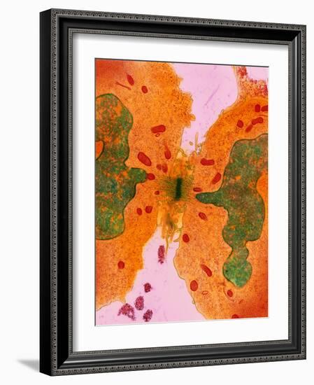 Coloured TEM of a Cancer Cell Dividing By-Steve Gschmeissner-Framed Photographic Print
