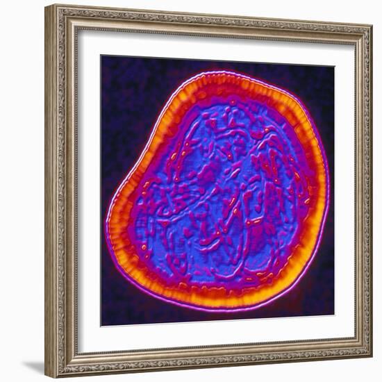 Coloured TEM of a Rubella (German Measles) Virus-PASIEKA-Framed Premium Photographic Print
