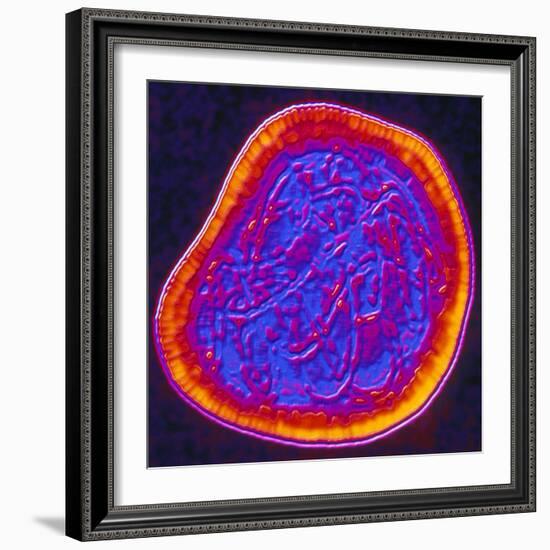 Coloured TEM of a Rubella (German Measles) Virus-PASIEKA-Framed Premium Photographic Print