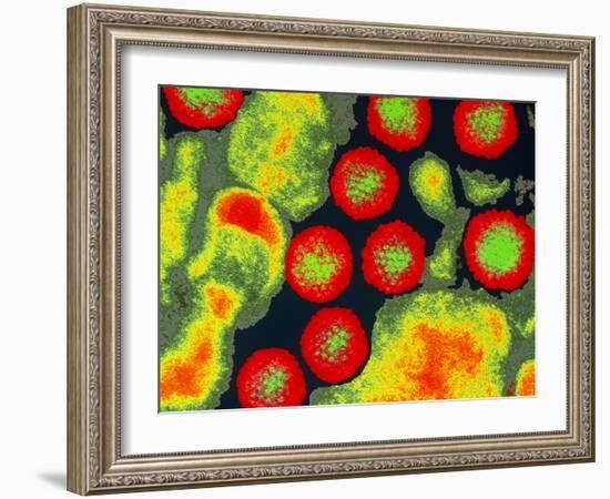 Coloured TEM of Adenoviruses-Dr. Linda Stannard-Framed Photographic Print