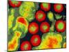 Coloured TEM of Adenoviruses-Dr. Linda Stannard-Mounted Photographic Print