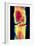 Coloured X-ray Image of a Normal Knee-joint-PASIEKA-Framed Photographic Print