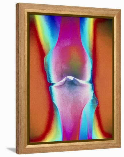 Coloured X-ray of a Human Knee Joint-Mehau Kulyk-Framed Premier Image Canvas