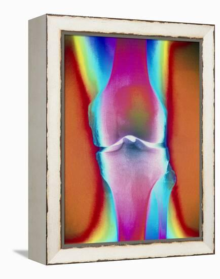 Coloured X-ray of a Human Knee Joint-Mehau Kulyk-Framed Premier Image Canvas