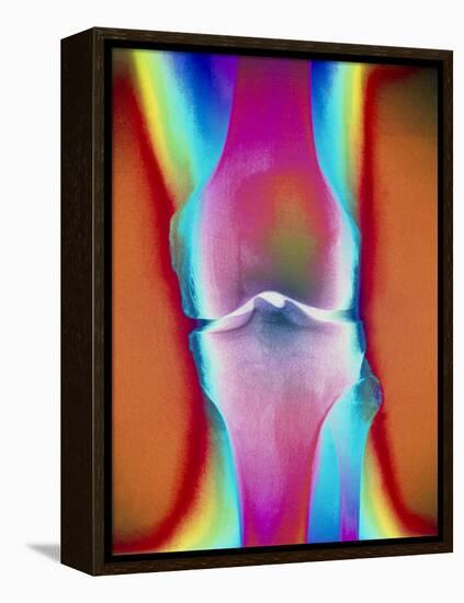 Coloured X-ray of a Human Knee Joint-Mehau Kulyk-Framed Premier Image Canvas