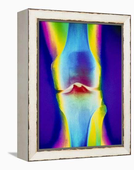Coloured X-ray of a Human Knee Joint-Mehau Kulyk-Framed Premier Image Canvas