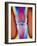 Coloured X-ray of a Human Knee Joint-Mehau Kulyk-Framed Photographic Print