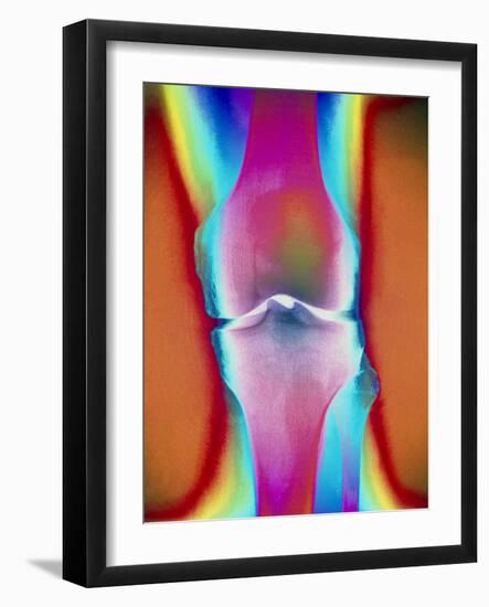 Coloured X-ray of a Human Knee Joint-Mehau Kulyk-Framed Photographic Print