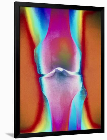 Coloured X-ray of a Human Knee Joint-Mehau Kulyk-Framed Photographic Print