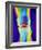 Coloured X-ray of a Human Knee Joint-Mehau Kulyk-Framed Photographic Print